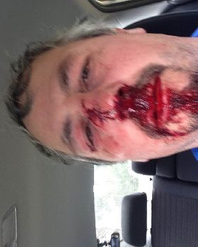ouch!