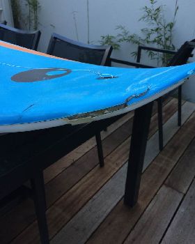 nose job