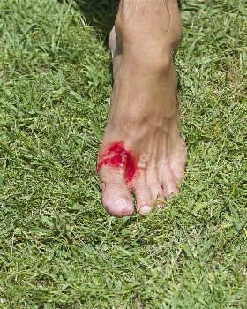 bloody foot