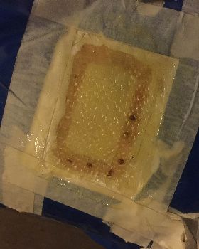F2 Lightning foot plug repair