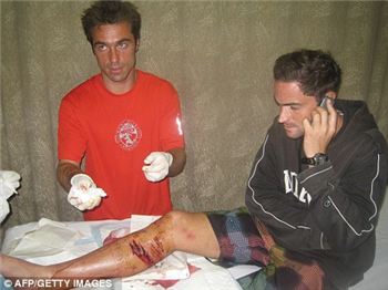 Another shark mauling - French Kitesurfer off Port Moresby - Kitesurfing News